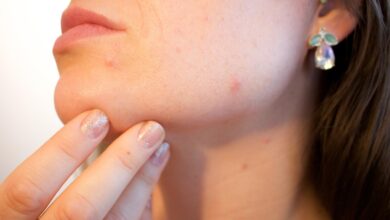 stages of a blind pimple