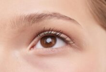 eye care product recall​