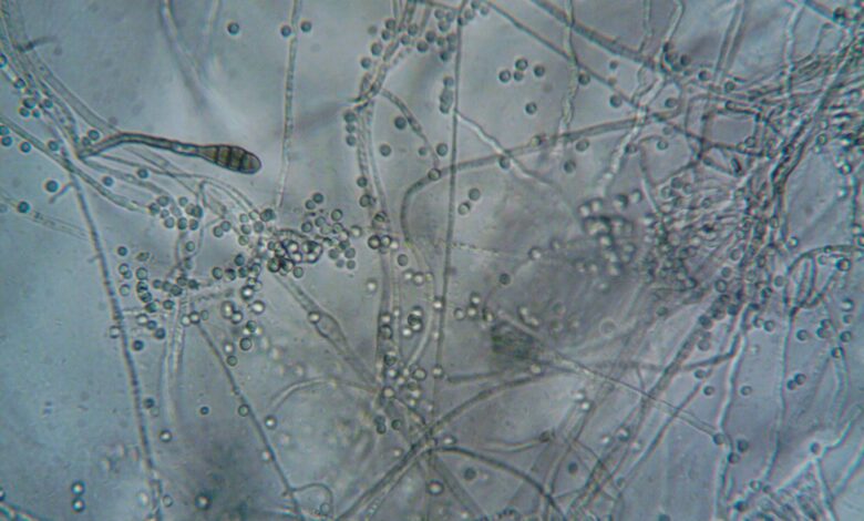 sexually transmitted fungal infections